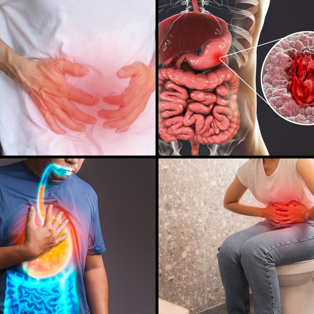 Gastroenterologia: indicazioni della Cannabis Medica