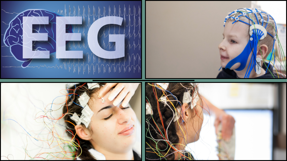 Epilessia e alimentazione